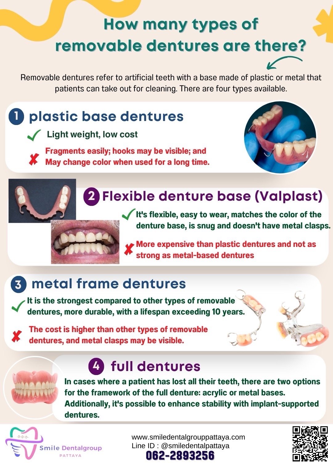 How many types of removable dentures are there? - Smile Dental Group ...